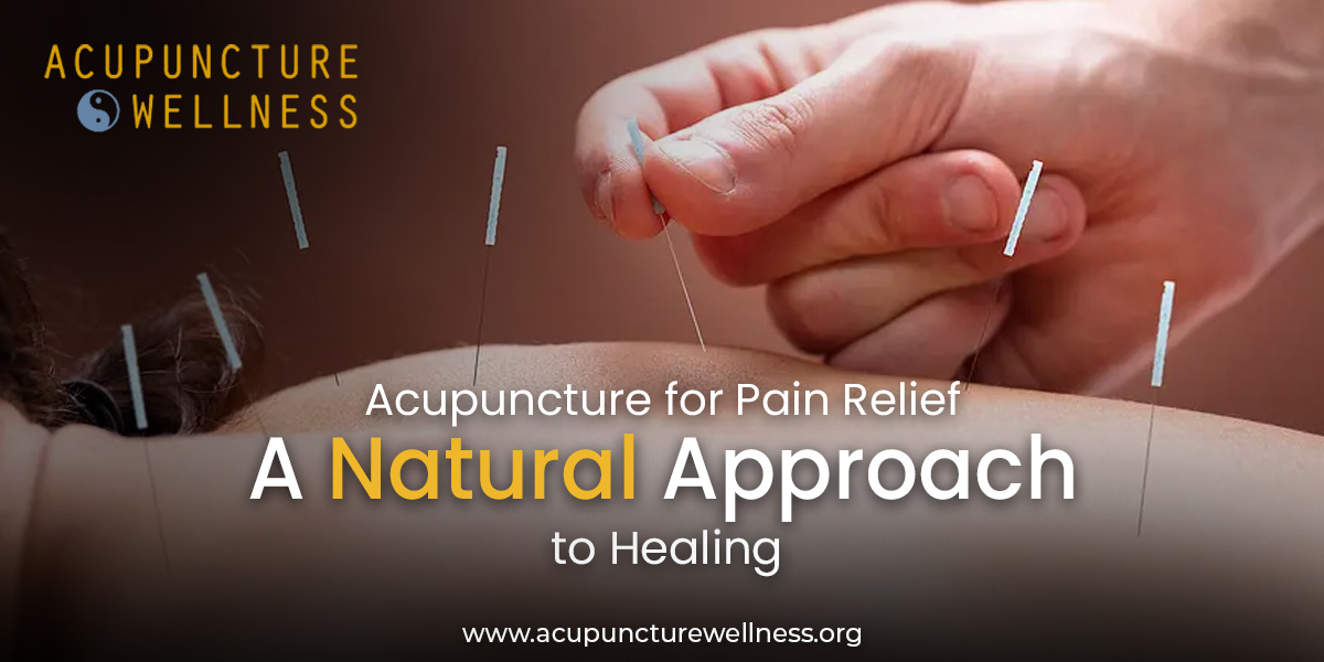 Acupuncture for Pain Relief A Natural Approach to Healing