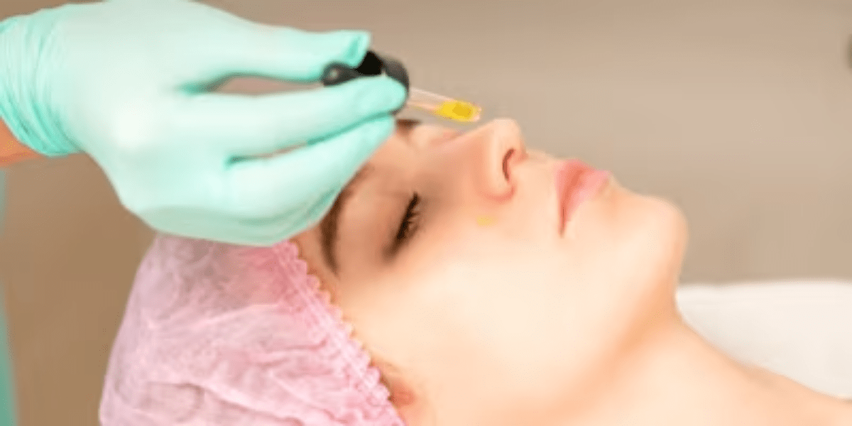 Microneedling treatment banner image