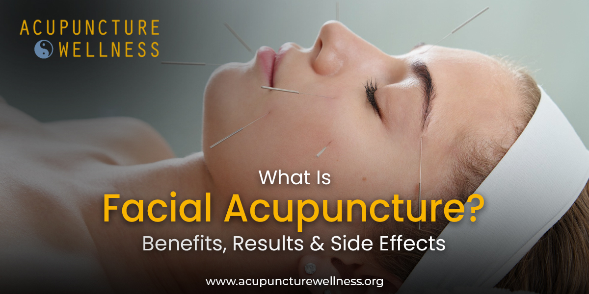 Facial Acupuncture