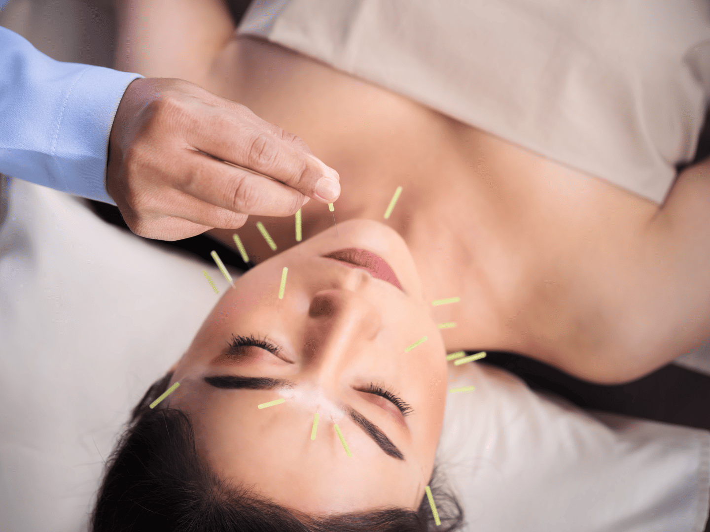 acupuncture-menopause-hero-image