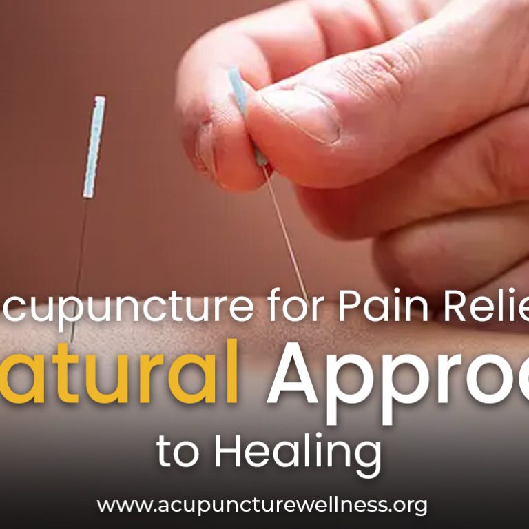 Acupuncture for Pain Relief A Natural Approach to Healing