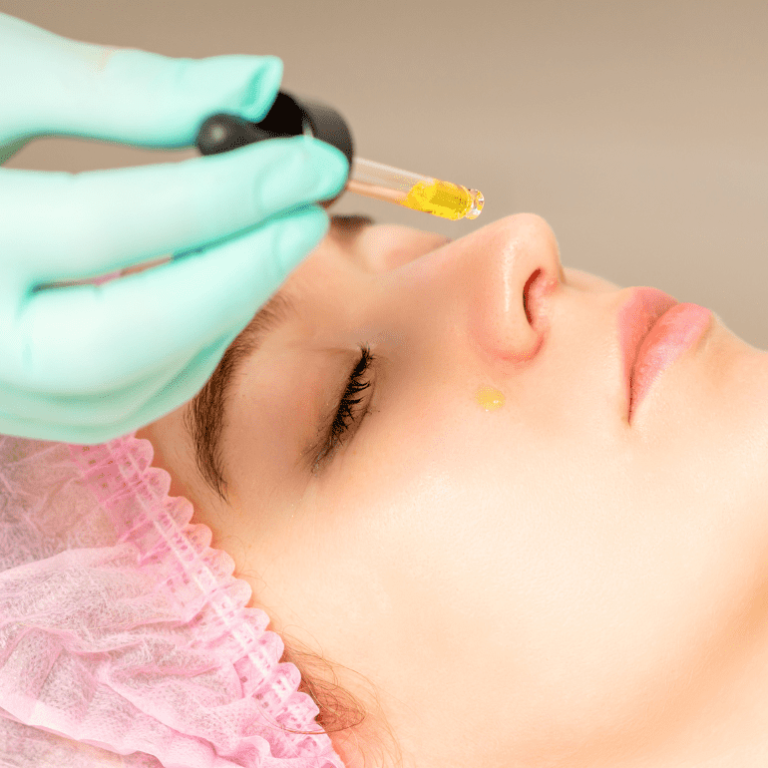 Microneedling treatment banner image