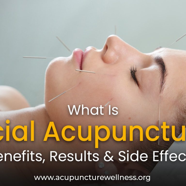 Facial Acupuncture